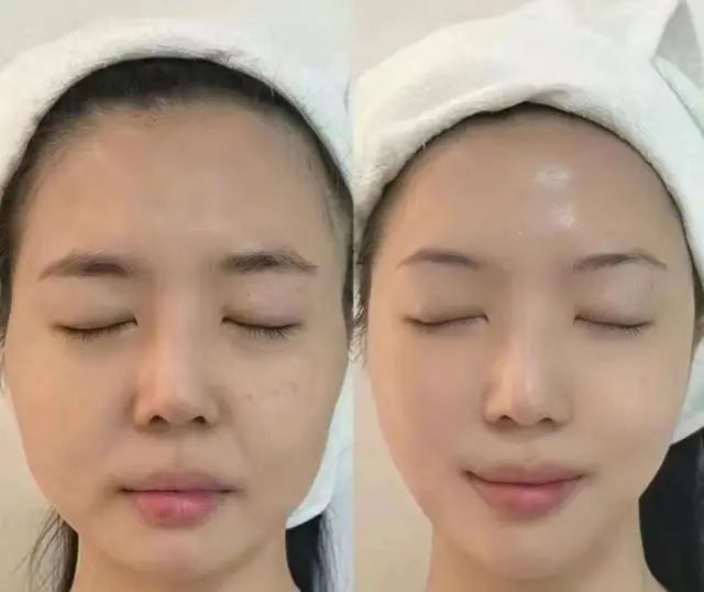 抗衰护肤品排行榜看看你的排在哪儿AG旗舰厅·(中国)国际厅抗老