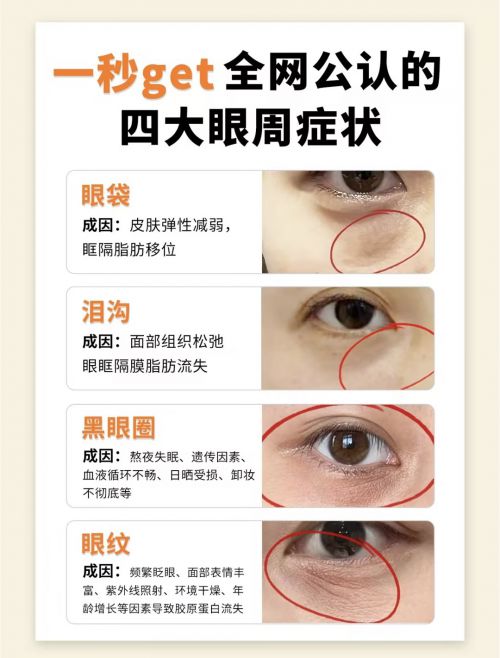 ？全网公认效果好的十大去皱眼霜排行榜AG旗舰厅app什么眼霜去皱效果好(图13)