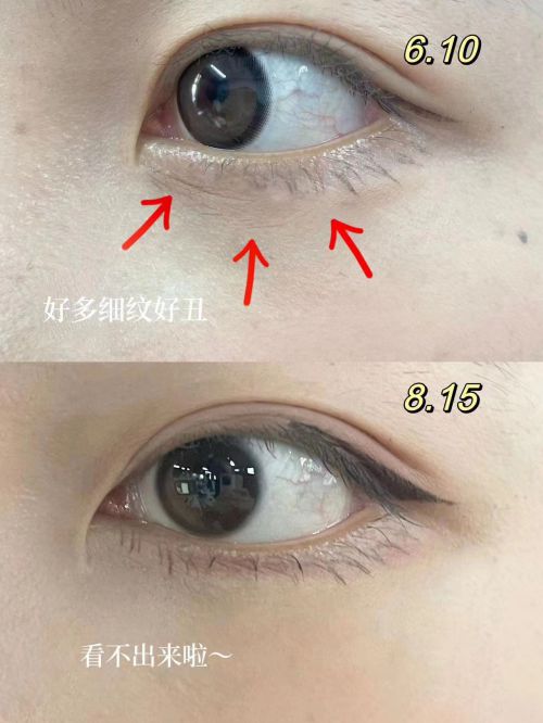 ？全网公认效果好的十大去皱眼霜排行榜AG旗舰厅app什么眼霜去皱效果好(图12)