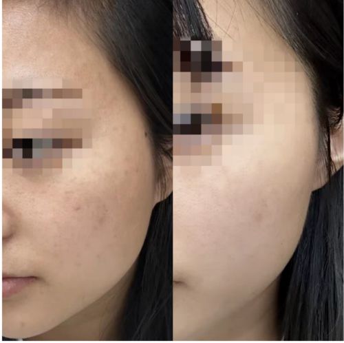 测：精选抗皱紧致精华重焕肌肤生机AG旗舰厅ios版抗皱紧致精华评